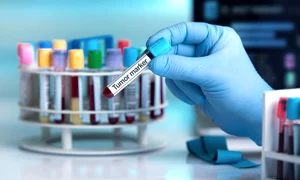 marker tumoral jpg