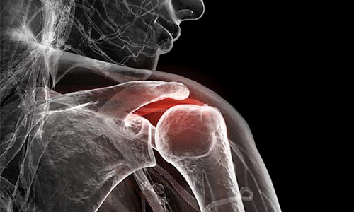 1 85225 original jpg jpeg