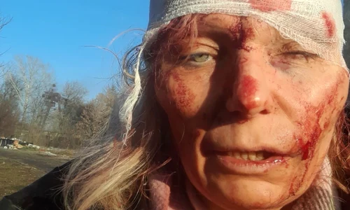 olena kurilo ucraina profimedia jpg