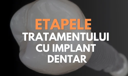 HzC4MAW   Imgur(1) png