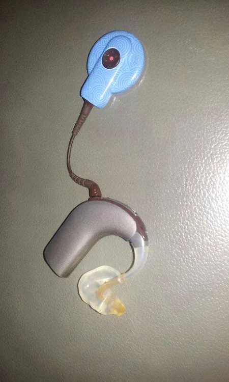 Aparatul auditiv costă 15.000 de euro