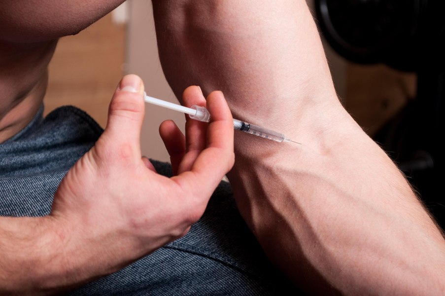Pericolul steroizilor pe care îi iau tinerii ca să aibă un corp de invidiat. Medic: „Vasele sanguine devin insuficiente”