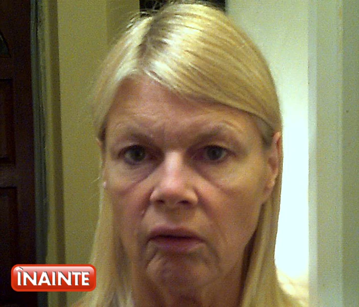 
    Karen Hogan arăta mai bătrână decât vârsta ei după ce a slăbit. Imagine făcută de ea înainte de operaţieFoto: arhivă personală  