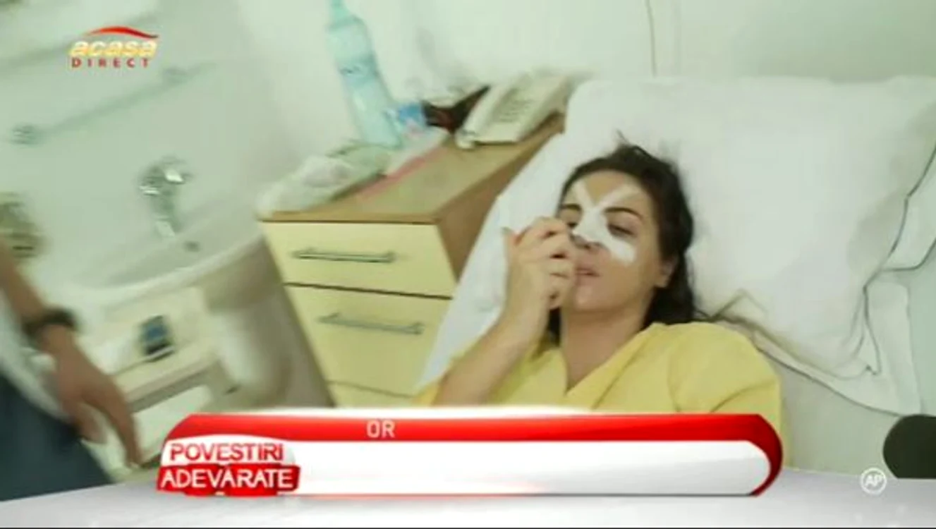Cristina Roman a mai suferit o intervenţie chirurgicală la nas în urmă cu doi ani