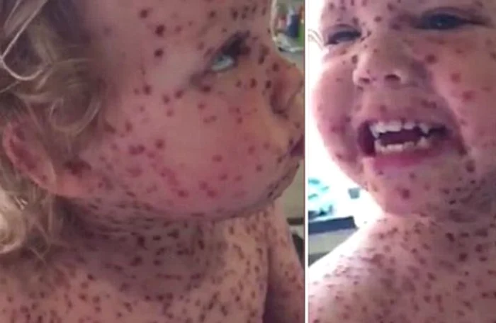 Băiețelul a petrecut 5 zile în spitalFoto: captură video Daily Mail