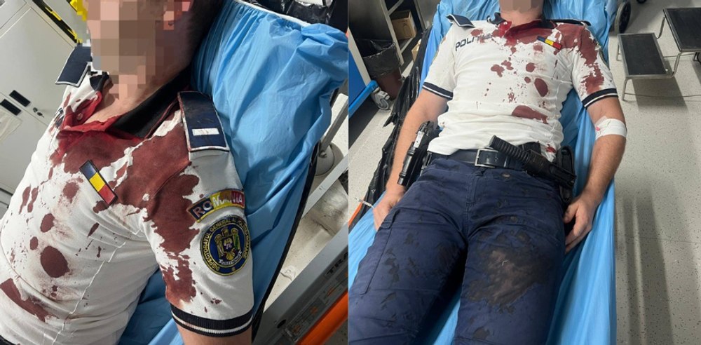 Imagini șocante cu un polițist rănit în misiune. A fost bătut crunt cu bâta, în timpul unei intervenții în Tulcea