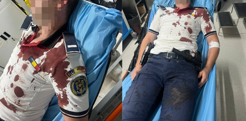 Imagini șocante cu un polițist rănit în misiune. A fost bătut crunt cu bâta, în timpul unei intervenții în Tulcea