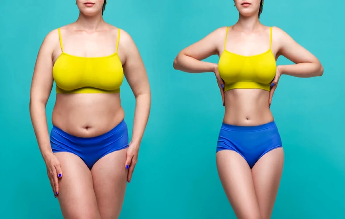 Metode surprinzătoare pentru a scăpa de grăsimea abdominală Foto bizrahmed com