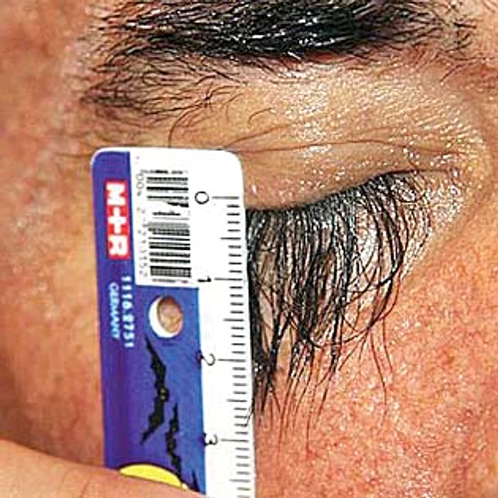 Genele lui Valery Smagliy măsoară 3 centimetri