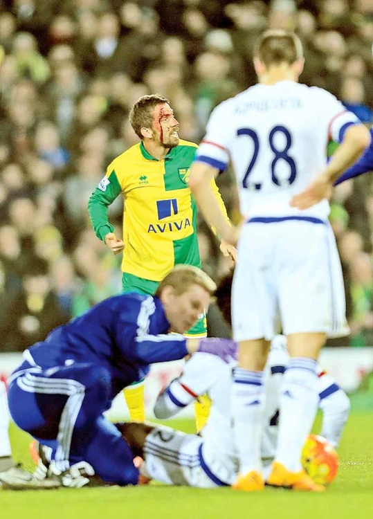 În timpul meciului cu Chelsea, un  fotbalist de la Norwich City a rămas  ştirb după un contact cu un coechipier