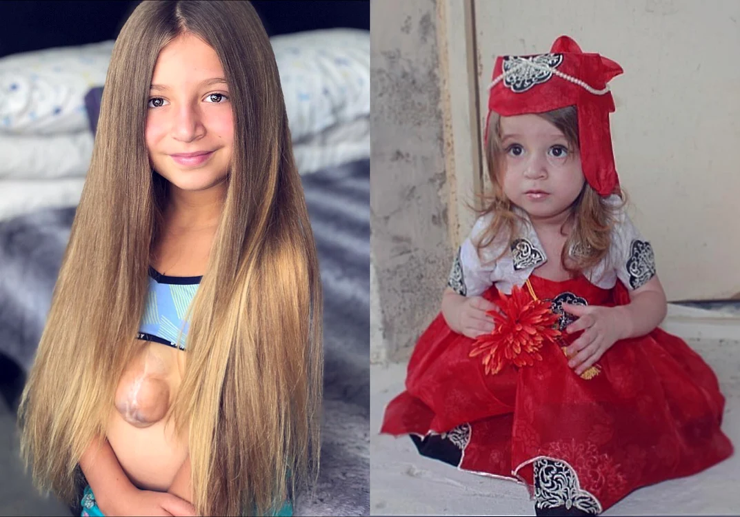 13 fetita cu inima in afara jpg jpeg