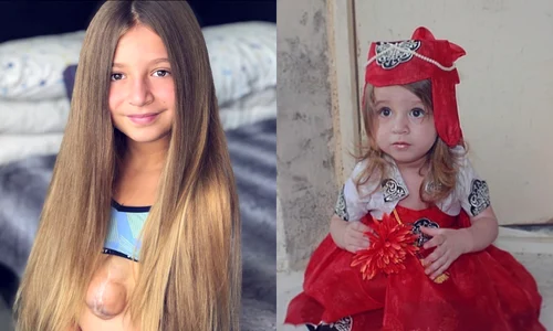 13 fetita cu inima in afara jpg jpeg