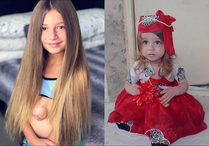 13 fetita cu inima in afara jpg jpeg