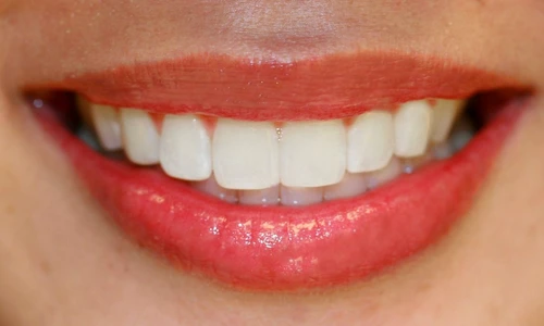 1 80224 original jpg jpeg