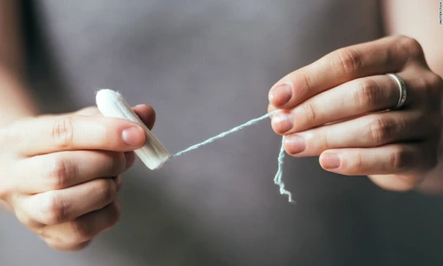 1 77911 original jpg jpeg