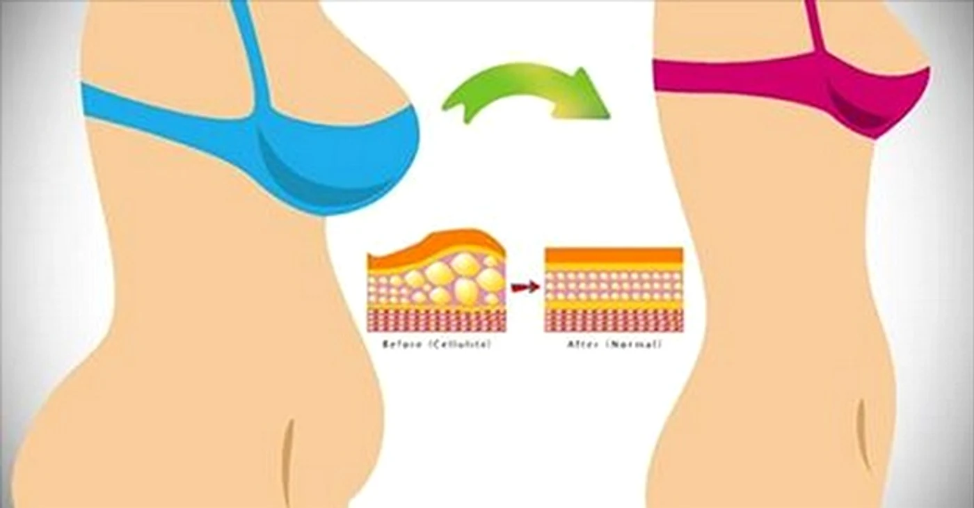 Metode de slăbit acasă  Cum să dai jos kilogramele în plus fără dietă jpeg