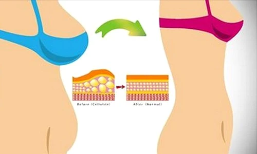 Metode de slăbit acasă  Cum să dai jos kilogramele în plus fără dietă jpeg