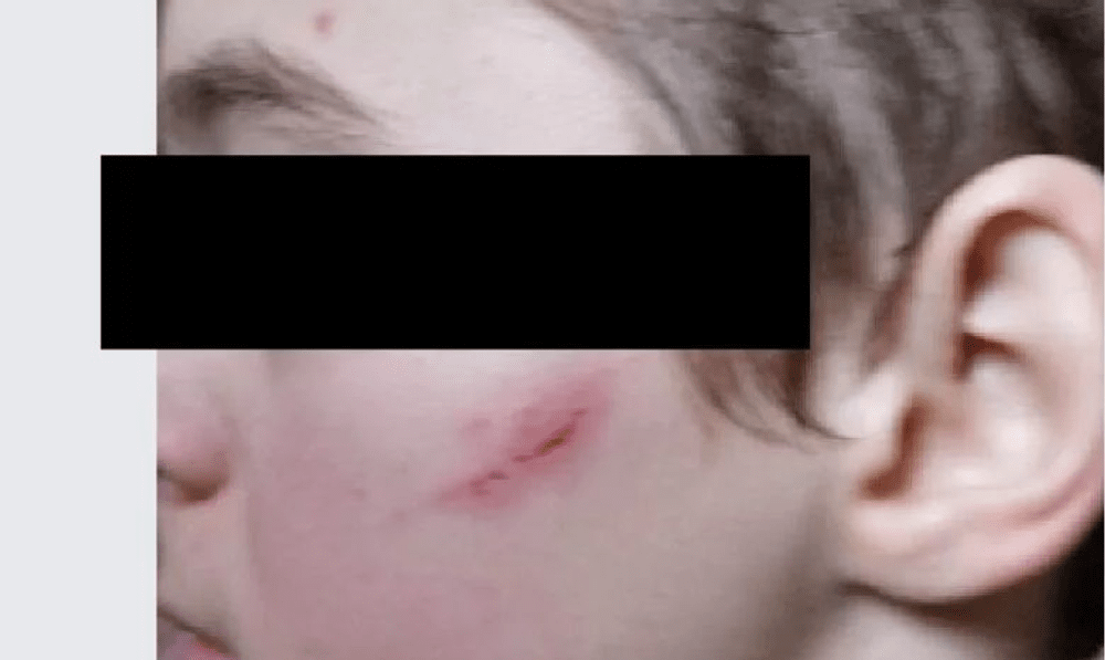 Suspiciuni de violență și răpire a unui elev din Bacău. Inspectoratul Școlar neagă mușamalizarea cazului