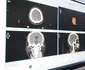 Centru de diagnosticare a cancerului, la Galați FOTO: CJ Galați