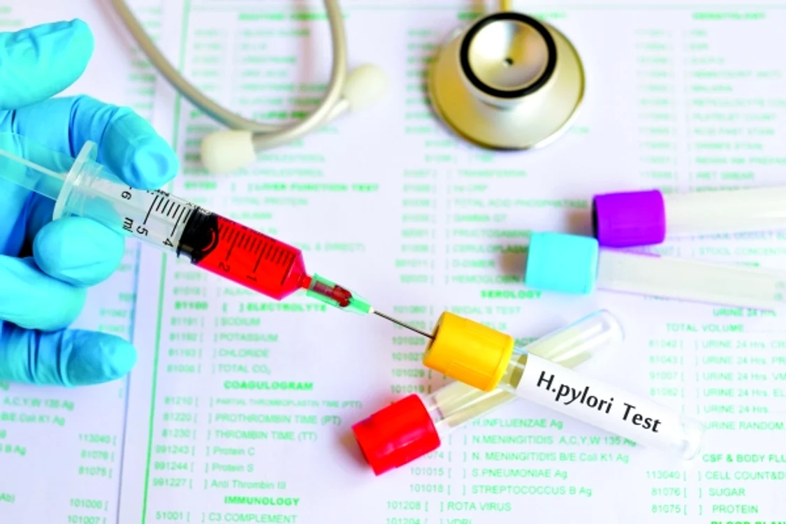 
    Dintre metodele de depistare a Helicobacter pylori, este frecvent folosită dozarea anticorpilor bacteriei în sânge.www.clicksanatate.ro  