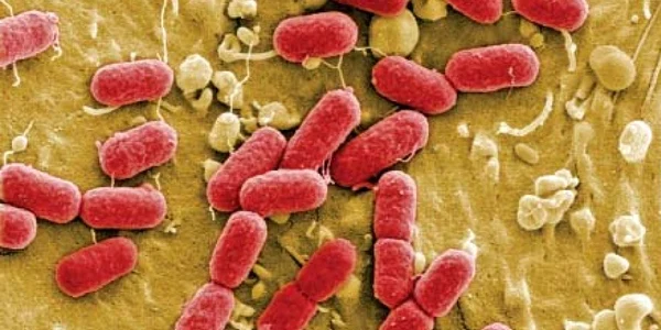 Laboratoarele lumii analizează potenţialul letal al bacteriei E.coli mutant  Foto: Reuters