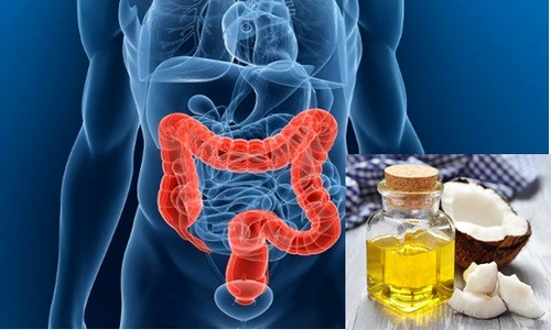 1 uleiul asta distruge 90 din cancerul la colon in 2 zile th7a jpg jpeg