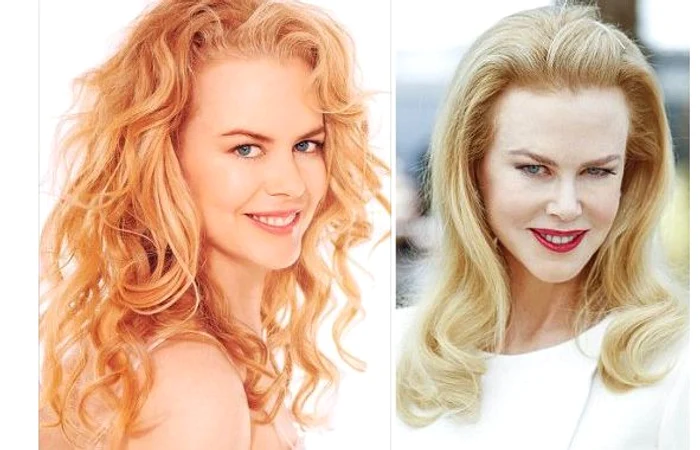 Vedete care artă horror după operațiile esteticecaptura foto