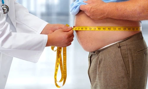 1 obezitate jpg jpeg