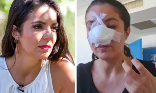 4 cristina joia operata la nas 2 jpg jpeg