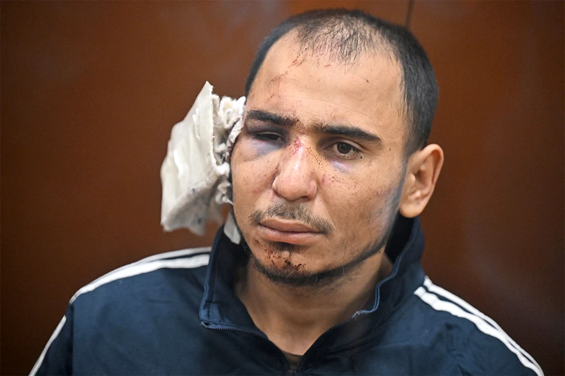 Un criminal avea urechea ruptă din momentul capturării. FOTO: Profimedia