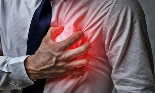 barcat care a facut infarct jpeg