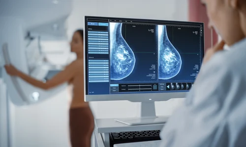 screening cancer mamar jpg