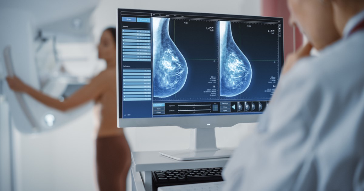 Specialiștii au aprobat un medicament care încetinește evoluția cancerului mamar. „Nu mă mai privesc ca pe o persoană pe moarte”