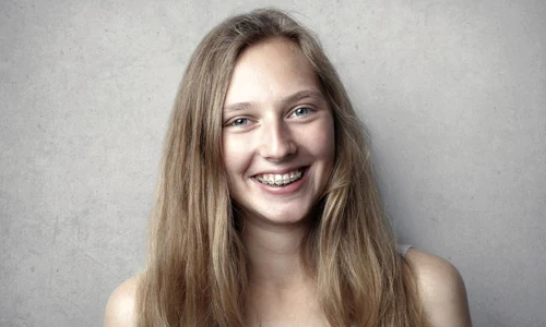 4 curiozități despre îndreptarea dinților jpeg