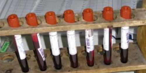 Buzău: Din ce în ce mai mulţi donatori de sânge