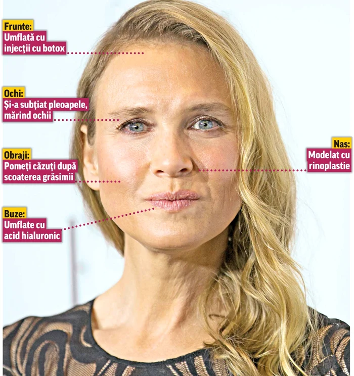 2014 Cu faţa desfigurată de operaţii esteticefoto: photoland/wenn