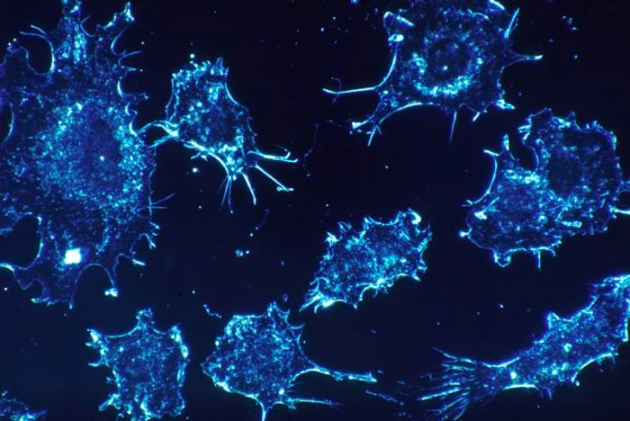 
    Dacă mănânci citrice, în special lămâi, poți preveni declanșarea anumitor tipuri de cancer.www.clickpentrufemei.ro  