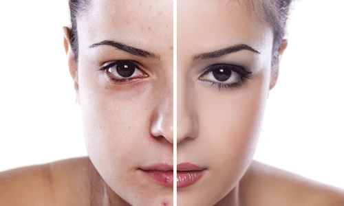 1 33472237798 a125852521 o gif gif