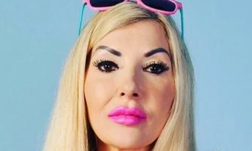 Rachel Evans a trecut prin 105 de intervenţii chirugicale, dar nu vrea să se oprească aici  jpeg