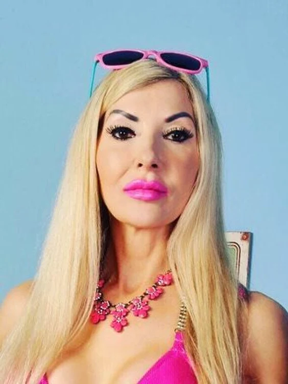 Rachel Evans a trecut prin 105 de intervenţii chirugicale, dar nu vrea să se oprească aici