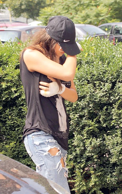 A rămas cu cicatrici la mâini și la sâni