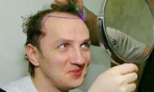 Mihai a suportat  două “operaţii” jpeg
