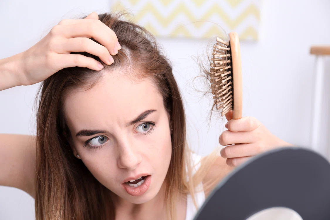 Căderea părului poate fi stopată cu remedii naturale FOTO Shutterstock