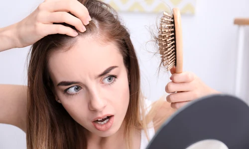 Caderea parului_shutterstock 1290376171 jpg