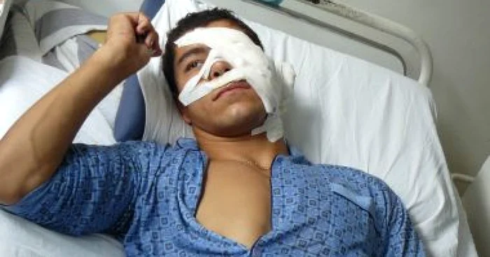 Târgu-Jiu: Poliţistul comunitar tăiat pe faţă va face operaţie estetică