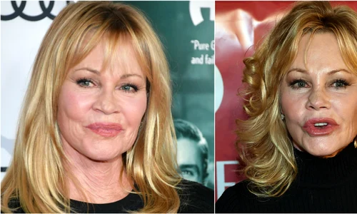 melanie inainte dupa jpeg