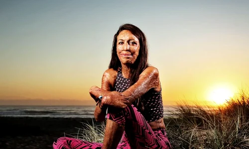 turia pitt jpeg