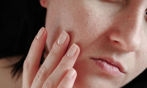 1 pori dilatati jpg jpeg