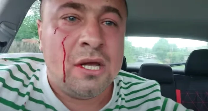 
    Trei persoane reţinute în cazul bărbatului agresat în traficFoto: News.ro  