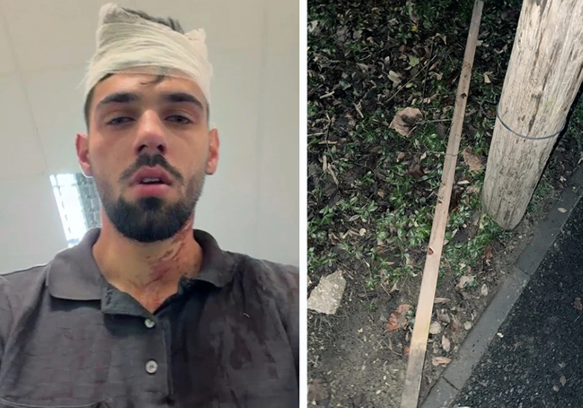 Mai mulți fotbaliși de la Poli Timișoara, acuzați că au bătut cu bestialitate un adolescent de 19 ani. „Dacă avea cu câteva kilograme mai puţin, îi măturam creierii de pe asfalt”